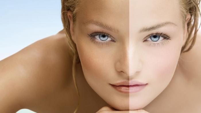Ingin Wajah Putih Alami? Pakai Serum MS Glow untuk Flek Ingin Wajah Putih Alami? Pakai Serum MS Glow untuk Flek