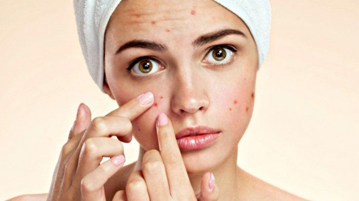 Paket Ms Glow Acne Series - Untuk Kulit Berjerawat Paket Ms Glow Acne Series - Untuk Kulit Berjerawat