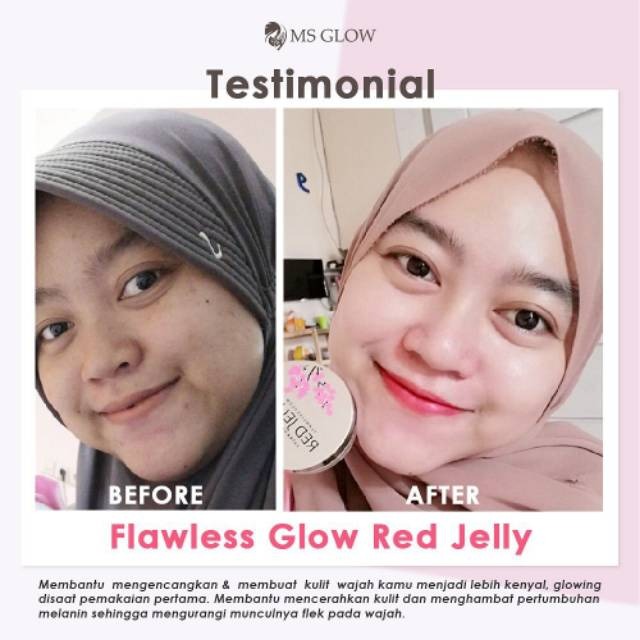 Cara Cepat Membuat Wajah Glowing Pakai Red Jelly MS Glow Cara Cepat Membuat Wajah Glowing Pakai Red Jelly MS Glow