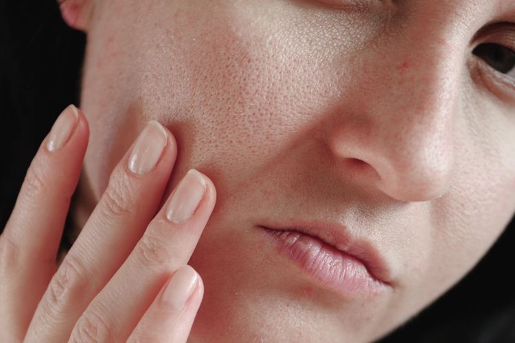 Cara Mengecilkan Pori-Pori Wajah Menggunakan MS Glow Cara Mengecilkan Pori-Pori Wajah Menggunakan MS Glow