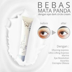 Testimoni & Review Eye Cream MS Glow !! Testimoni & Review Eye Cream MS Glow !!