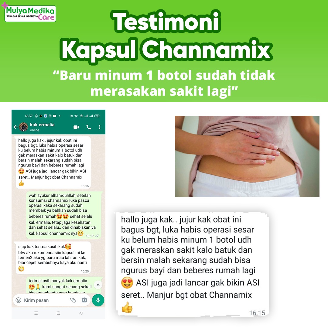 Channamix: Kapsul Ikan Gabus Premium, 7x Mempercepatn Proses Penyembuhan Luka Pasca Operasi