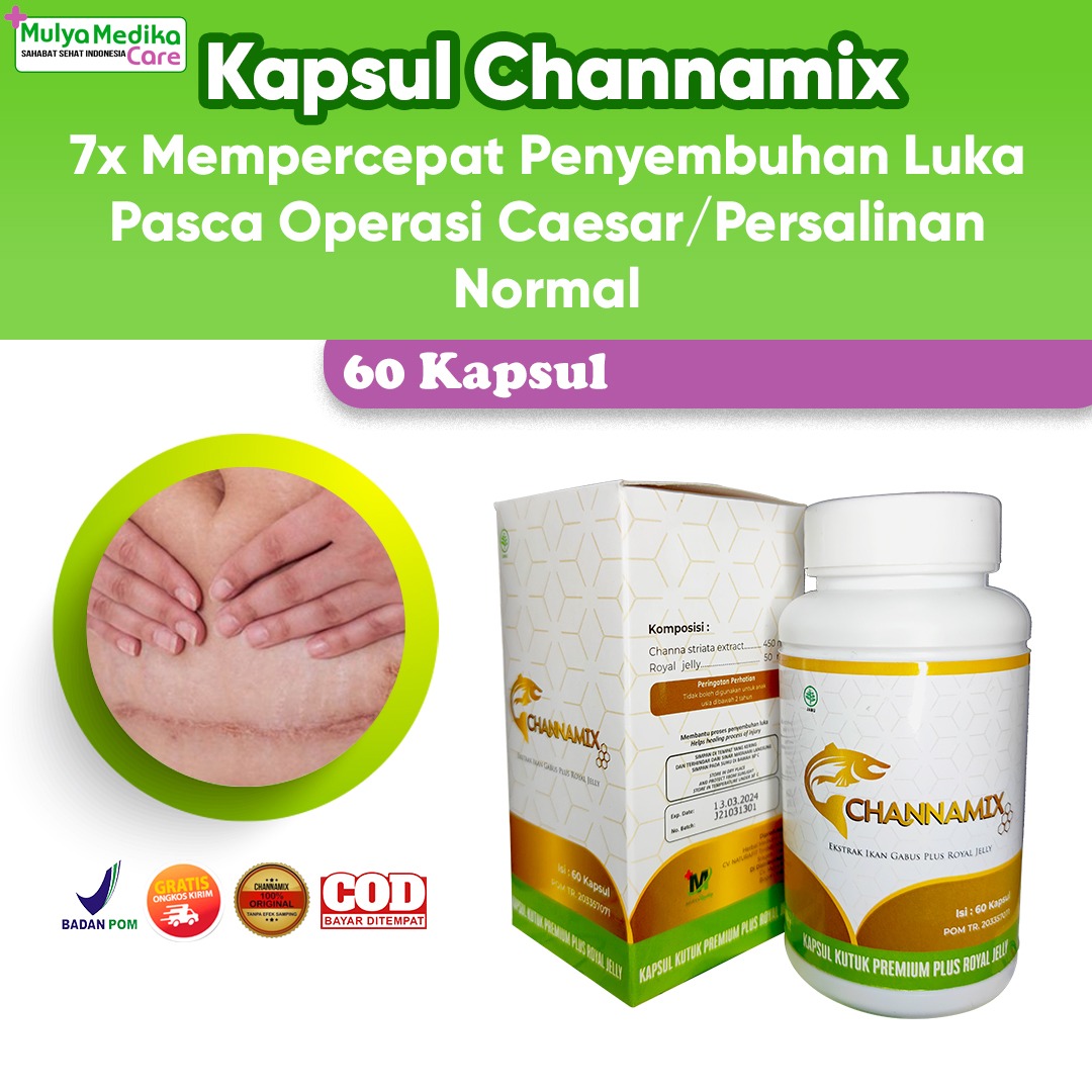 Channamix: Kapsul Ikan Gabus Premium, 7x Mempercepat Proses Penyembuhan Luka Pasca Operasi
