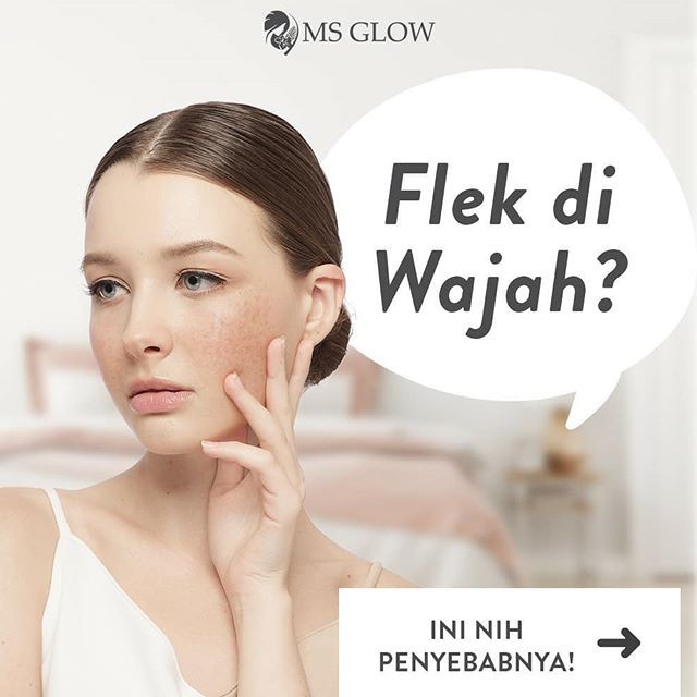 Ms Glow Ultimate Diformulasikan Sebagai Treatment Wajah Flek Hitam