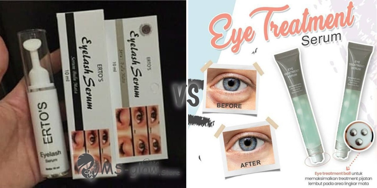 Review Ertos Eyelash Serum vs MS Glow Eye Treatment Serum