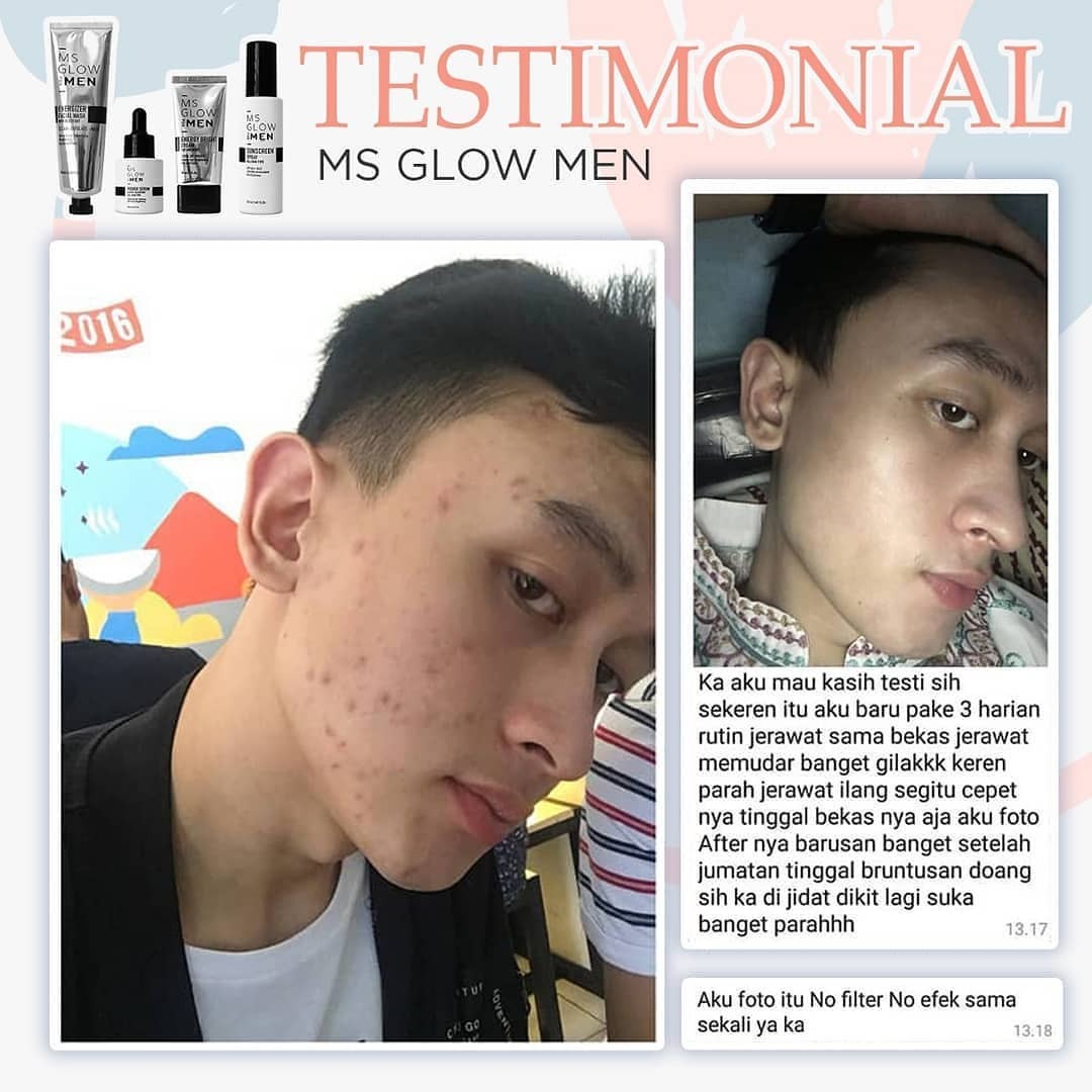 Skincare Cowok Harga Anak Kost MS Glow For Men