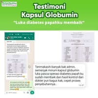 TESTIMONI KAPSUL KUTUK GLOBUMIN - 7X Mempercepat Penyembuhan Luka Pasca Berbagai Operasi