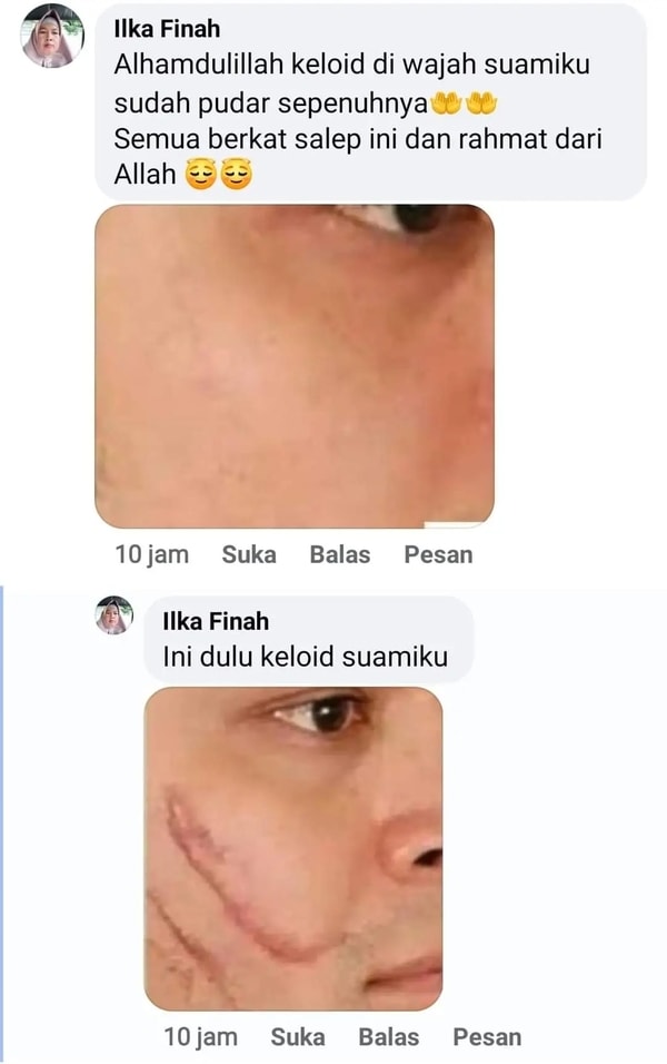 -