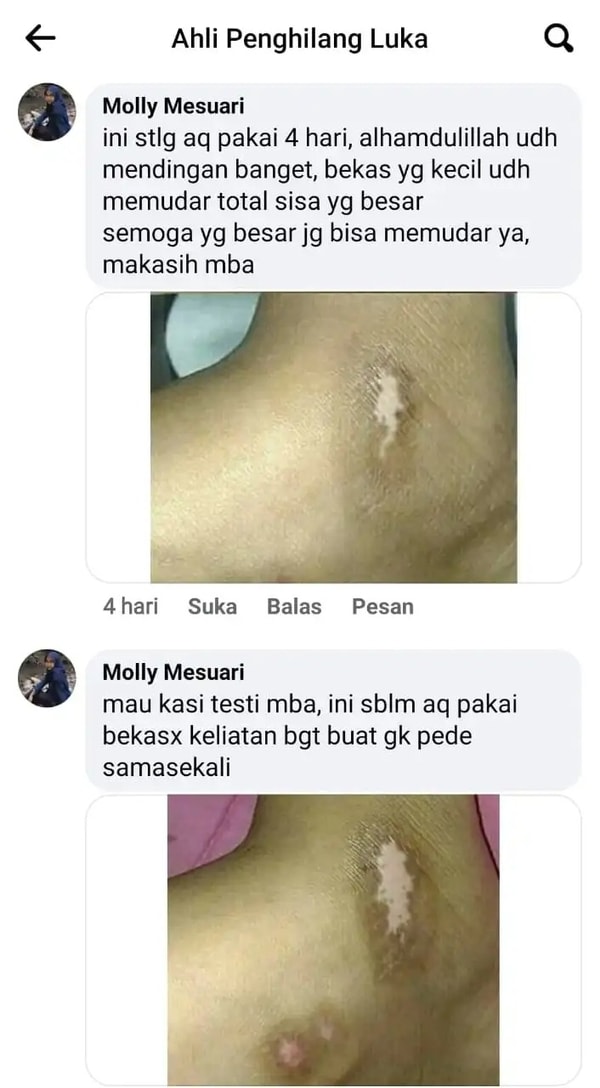 -