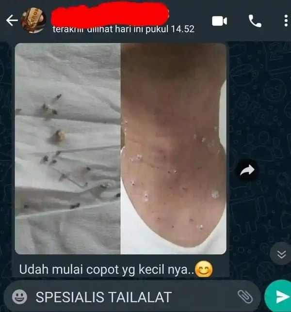 -