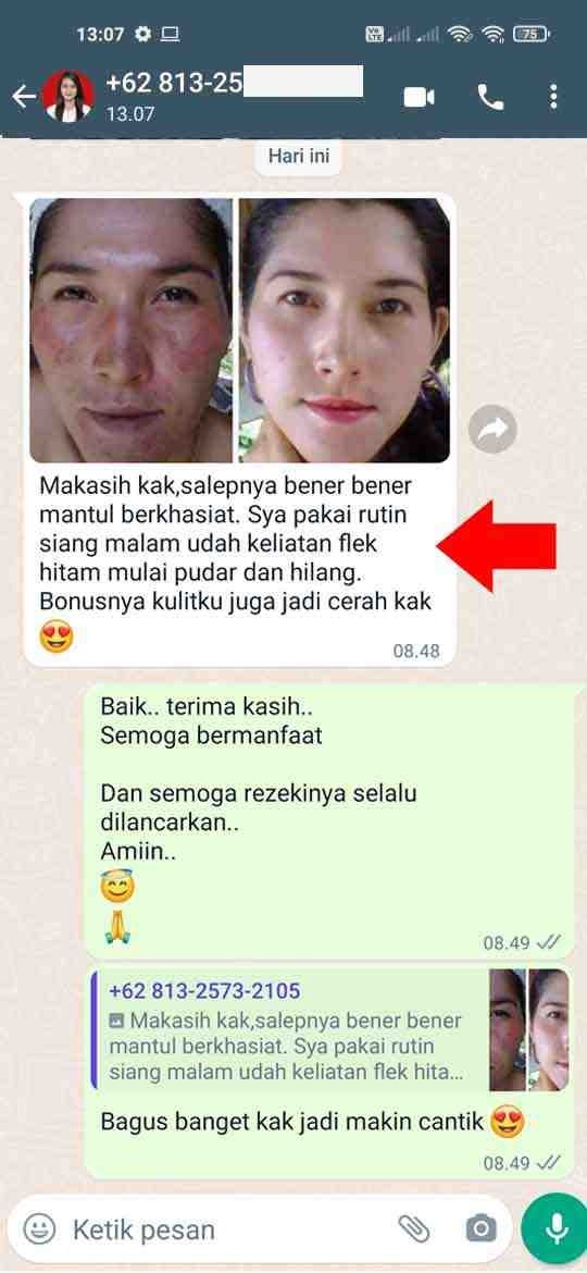 -