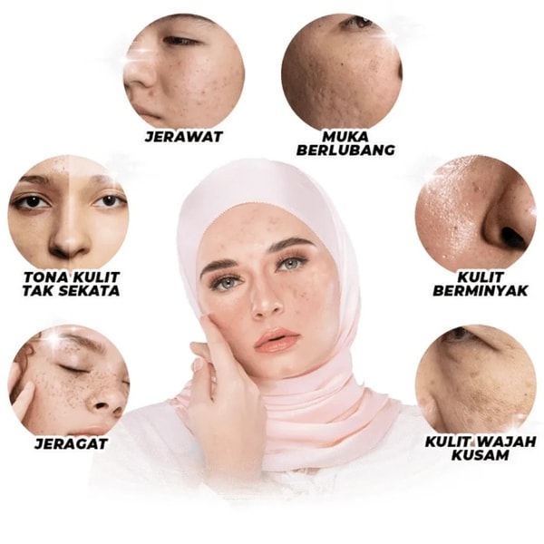 Masalah wajah yang sering di alami