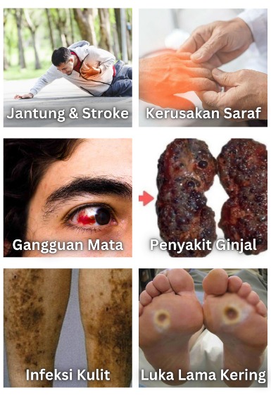 -