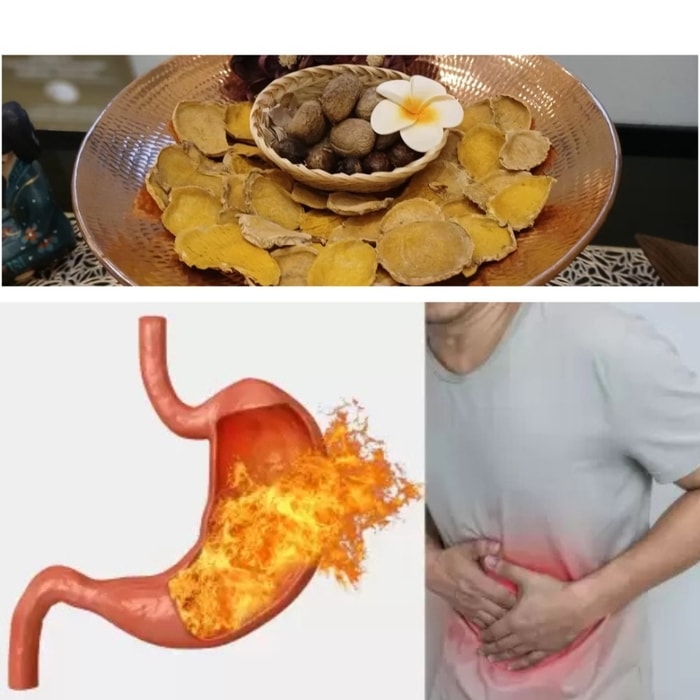 -