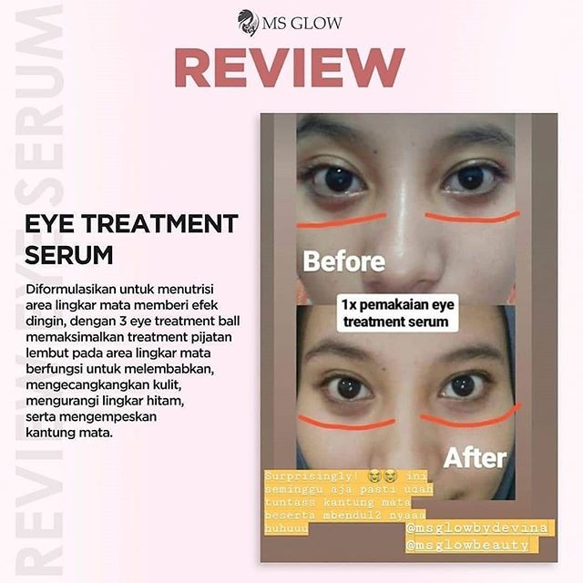 Eye Treatment Serum