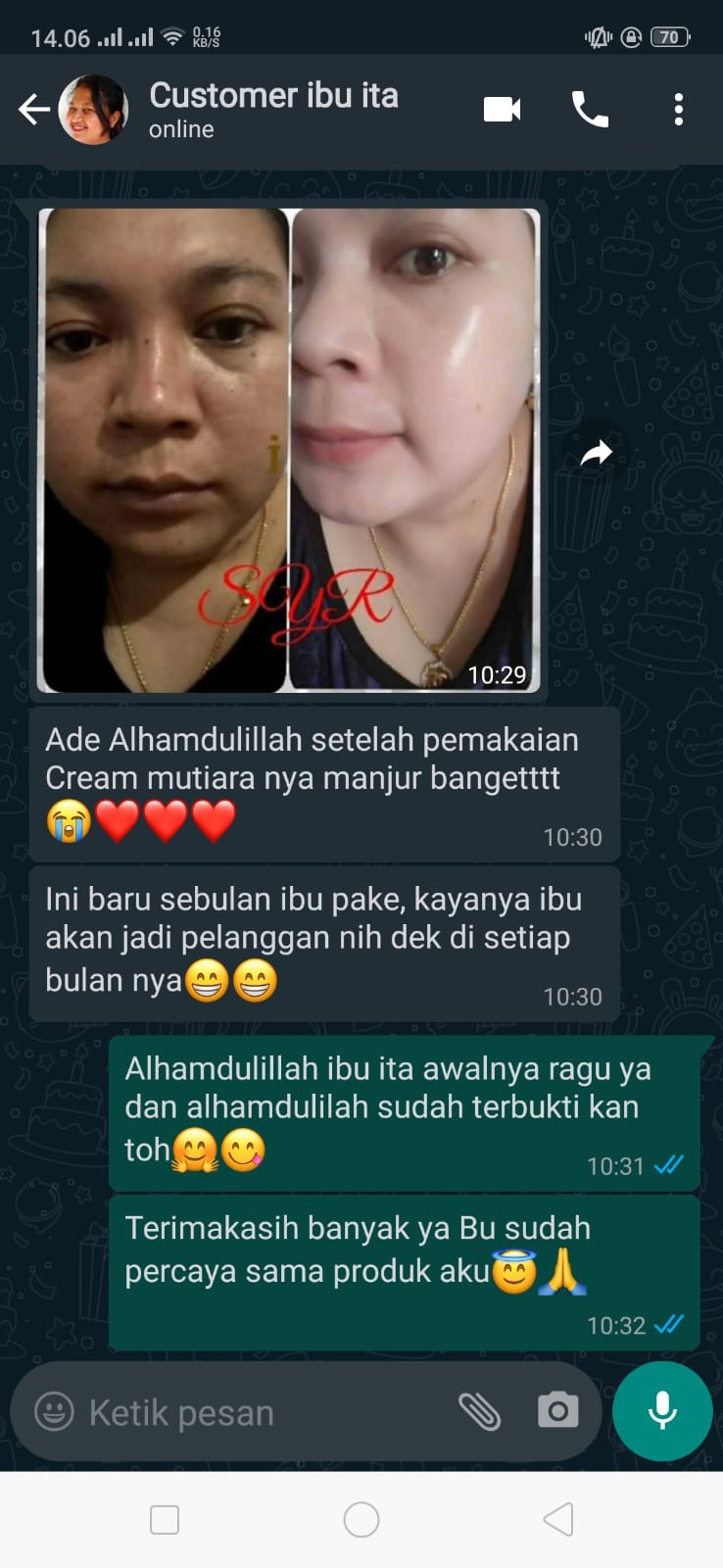 -