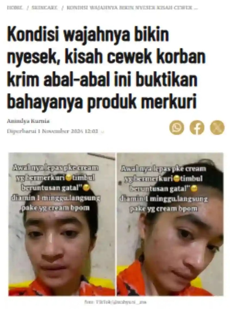 -