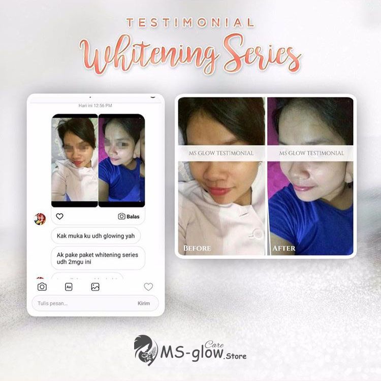 Review Whitening Series