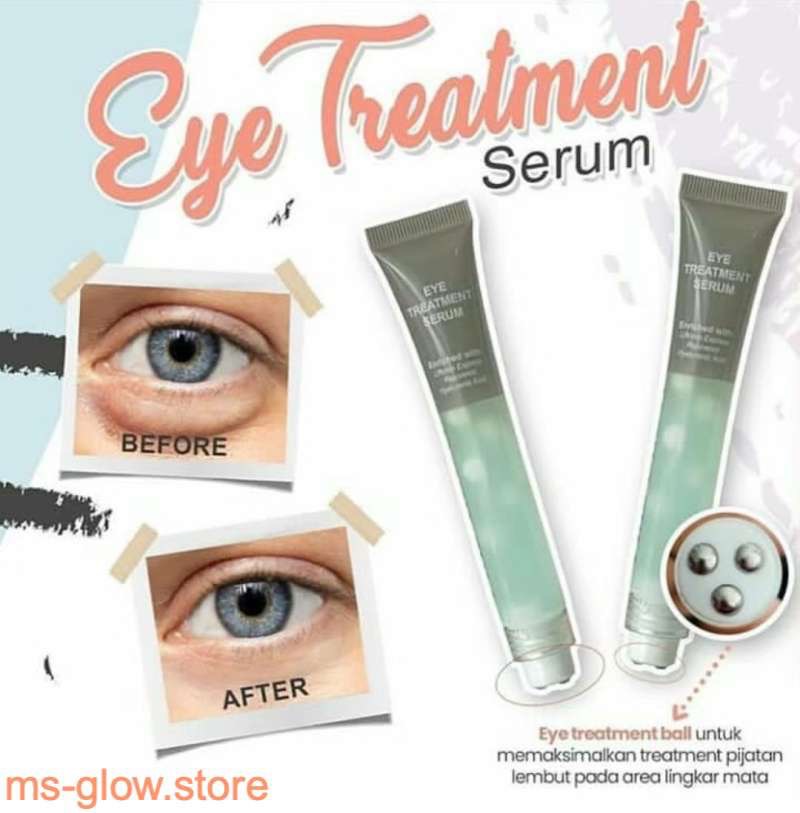 Eye Treatment Serum dari MS Glow