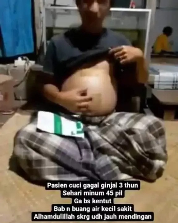 -